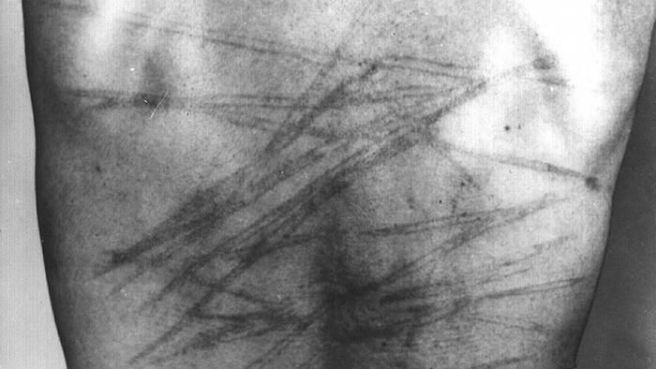 Corps social, corps strié. Stries